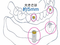 小さな装置